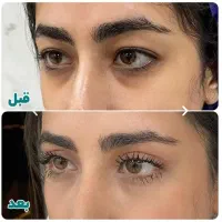 مرکز تخصصی پوست و مو بلفاروپلاستی|خدمات آرایشگری و زیبایی|تهران, جردن|دیوار
