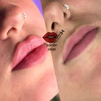 فیلر اودری سیسی 750