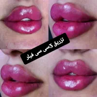 جشنواره خدمات حرفه ای درمان پوست و مو