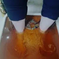 حجامت و زالوتراپی و طب سوزنی‌و پاکسازی بدن از سمو|خدمات آرایشگری و زیبایی|ارومیه, |دیوار