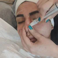 پاکسازی فیشال جوانسازی پوست|خدمات آرایشگری و زیبایی|شیراز, شهرک سراج‎|دیوار