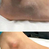 رفع تیرگی های بدن و صورت