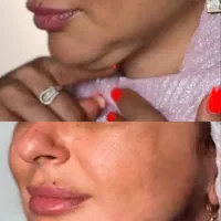 جشنواره کلینیک زیبایی مهسان|خدمات آرایشگری و زیبایی|قم, صدوق|دیوار