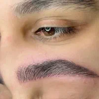 مدل میکروبلیدینگ