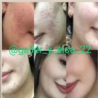 کرم سفید کننده صورت و بدن