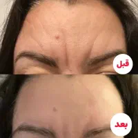 کرم بوتاکس پنج کاره گاتیو|آرایشی، بهداشتی، درمانی|تهران, مشیریه|دیوار