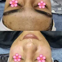 فیشیال تخصصی توسط پیراپزشک با۳۰٪تخفیف درکلینیک|خدمات آرایشگری و زیبایی|شیراز, خلدبرین|دیوار