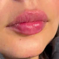 همکاری با گروه کاشت و مو