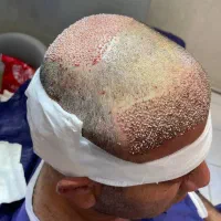 عمل بلفاروپلاستی/عمل بینی/ کاشت ابرو/ کاشت مو|خدمات آرایشگری و زیبایی|اندیشه, اندیشه فاز ۱|دیوار