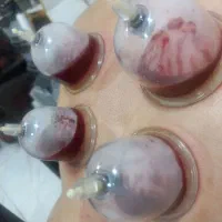 کار طب سنتی با آموزش ودرآمد در منزل|استخدام درمانی، زیبایی، بهداشتی|قرچک, زیبا شهر|دیوار