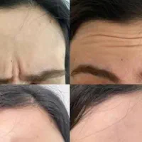 جشنواره ژل و بوتاکس 30درصد تخفیف|خدمات آرایشگری و زیبایی|کوهدشت, |دیوار