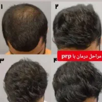 رزماری گیاهی برای کسانی که مو میریزه|گل و گیاه طبیعی|خرمشهر, |دیوار