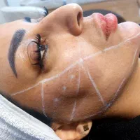 تزریق ژلوبوتاکس تخصصی در پرندبا نازلترین قیمت|خدمات آرایشگری و زیبایی|پرند, فاز ۲|دیوار