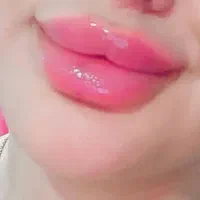 تزریق فیلر و بوتاکس درمطب