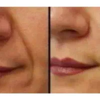 پک جوانسازی تضمینی با مشاوره تخصصی رایگان