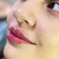 فیلر لب قیمت ویژه وهایفوتخفیف فوق العاده|خدمات آرایشگری و زیبایی|یزد, |دیوار