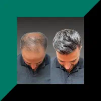 تحولی در چهرت ایجاد کن