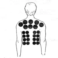 حجامت فصد قلنج بادکش و فقط آقا