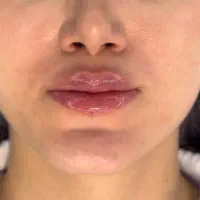 استخدام بازاریاب یا مشاور فروش کلینیک زیبایی