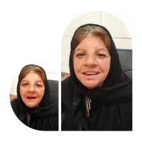 دندانسازی و ساخت دندان مصنوعی باکیفیت طراحی لبخند