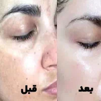 صابون لایه بردار