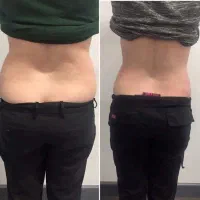 لاغری در شرق تهران (کلینیک تخصصی آرانا)