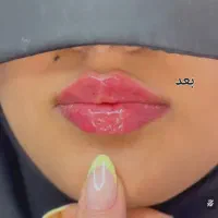 جشنواره لیزر موهای زاید بالای ۶۰٪تخفیف فیلر اقساطی|خدمات آرایشگری و زیبایی|کرمان, |دیوار