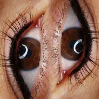 تتوی دائم صورت
