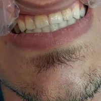 دندانپزشکی با تخفیف ٪40|خدمات آرایشگری و زیبایی|بروجرد, |دیوار