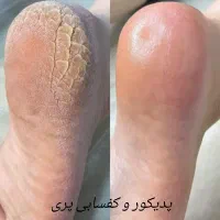 اولین کلینیک تخصصی پدیکور پا|خدمات آرایشگری و زیبایی|کرمانشاه, |دیوار