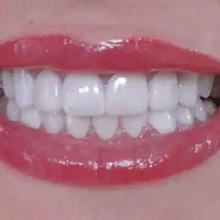لابراتوار پرسلن گذار سنگ چینی زن