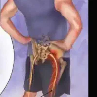 ماساژ درمانی رگ گیری قلنج شانه کتف کمر درد سیاتیک|خدمات آرایشگری و زیبایی|همدان, |دیوار