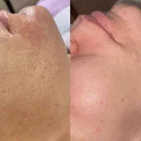 فیشیال تخصصی صورت و بدن تخفیف ویژه|خدمات آرایشگری و زیبایی|اصفهان, عسگریه|دیوار