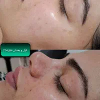 فیشیال تخصصی با بهترین برندو متریال کره ای|خدمات آرایشگری و زیبایی|رامهرمز, |دیوار