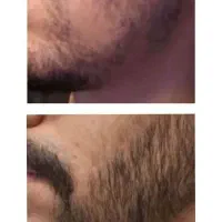 حسرت ریش نداشتن تو دلت نمی مونه