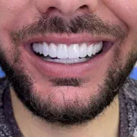 دندانپزشکی ایمپلنت ارتودنسی کامپوزیت اقساط