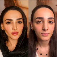 پایان جستجو کلینیک تخصصی پوست نخ هایفو آموزش ژل|خدمات آرایشگری و زیبایی|تهران, زعفرانیه|دیوار