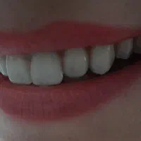 دندانسازی واعظی