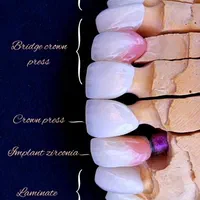 میخای تو 30 جلسه دندانسازی رو آموزش ببینی|خدمات آموزشی|ارومیه, |دیوار