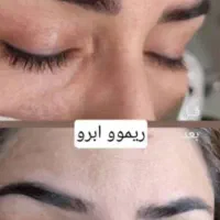 ریموو(پاک کردن)تتو ابرو چشم لب|خدمات آرایشگری و زیبایی|دوگنبدان, |دیوار