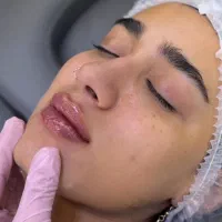 نیازمند مدل فیلر لب رایگان