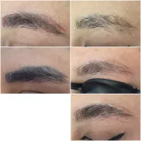 پاک کردن تتو۵۰۰/لیزر موهای زائد/فیشیال/خال برداری