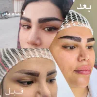 جشنواره پاییز میکروکاشت ابرو با و بدون جراحی|خدمات آرایشگری و زیبایی|کرمان, |دیوار