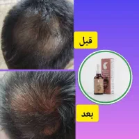 محصولات مو اریا پژوهش یکتاگیاهی ودانش بنیان|آرایشی، بهداشتی، درمانی|نیشابور, هفده شهریور|دیوار