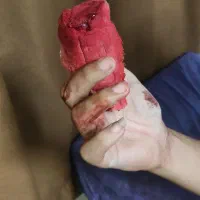 پانسمان وجراحی های سرپایی،ختنه،زگیل تناسلی|خدمات آرایشگری و زیبایی|اهواز, شریعتی جنوبی|دیوار