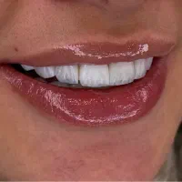 جشواره نوروزیی کامپوزیت واحدی۵۰۰