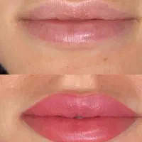 آموزش صفرتا صد فیبروز|خدمات آموزشی|سهند, |دیوار