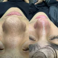 پدیکور فیشال پروتز مو روشن‌سازی تیرگی بدن و صورت