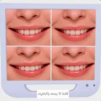 مانیتور سفید17 اینچ بسیارزیبا