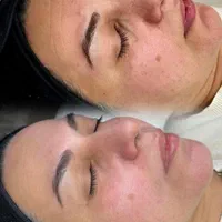 تخفیفات۵۰ درصدی ژل،بوتاکس،انزیم کیلینیک هستی|خدمات آرایشگری و زیبایی|کرمانشاه, |دیوار